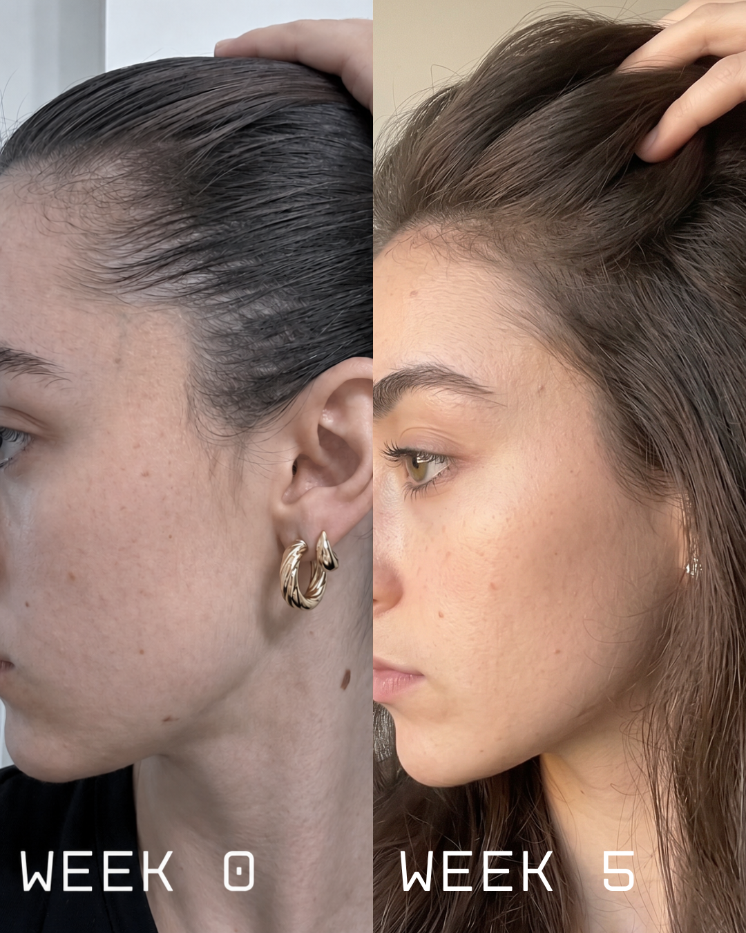 Customer story — 1
