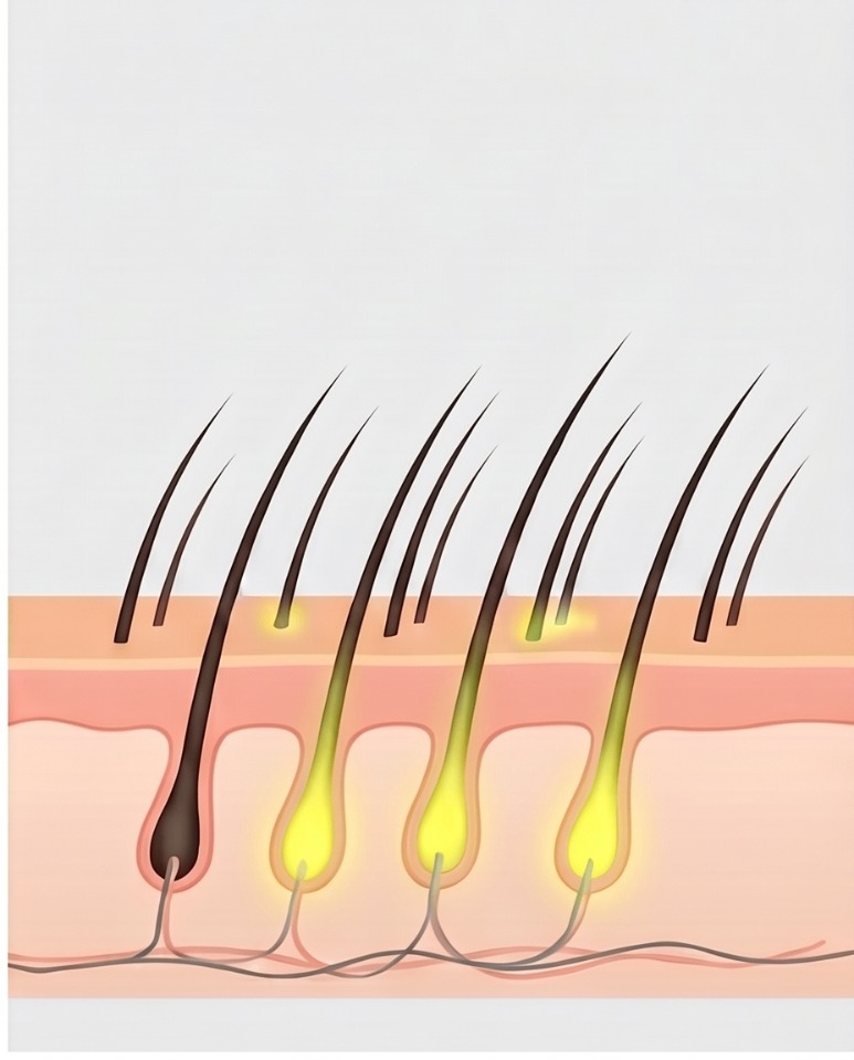 Scalp cross-section illustration showing strong, anchored hair follicles at week 4