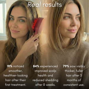 Nova 5-in-1 Scalp Rejuvenation System